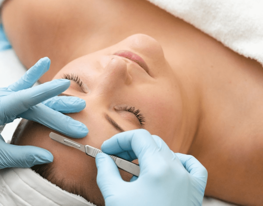 what are the benefits of dermaplaning